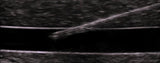 Shallow Multivessel Ultrasound Guided IV Phantom and Venous Trainer