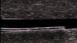 Shallow Multivessel Ultrasound Guided IV Phantom and Venous Trainer
