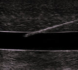 central line phantom trainer ultrasound
