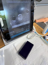 Ultrasound Guided Nerve Block Phantom Trainer