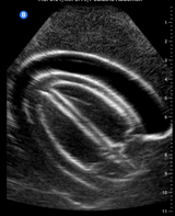 Adult Pericardiocentesis Ultrasound Phantom