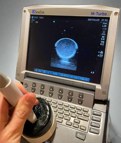 Deep Abscess Ultrasound Phantom Trainer (for needle drainage, drain placement, identification)