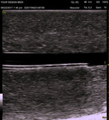 Ultrasound Guided IV Trainer Phantom